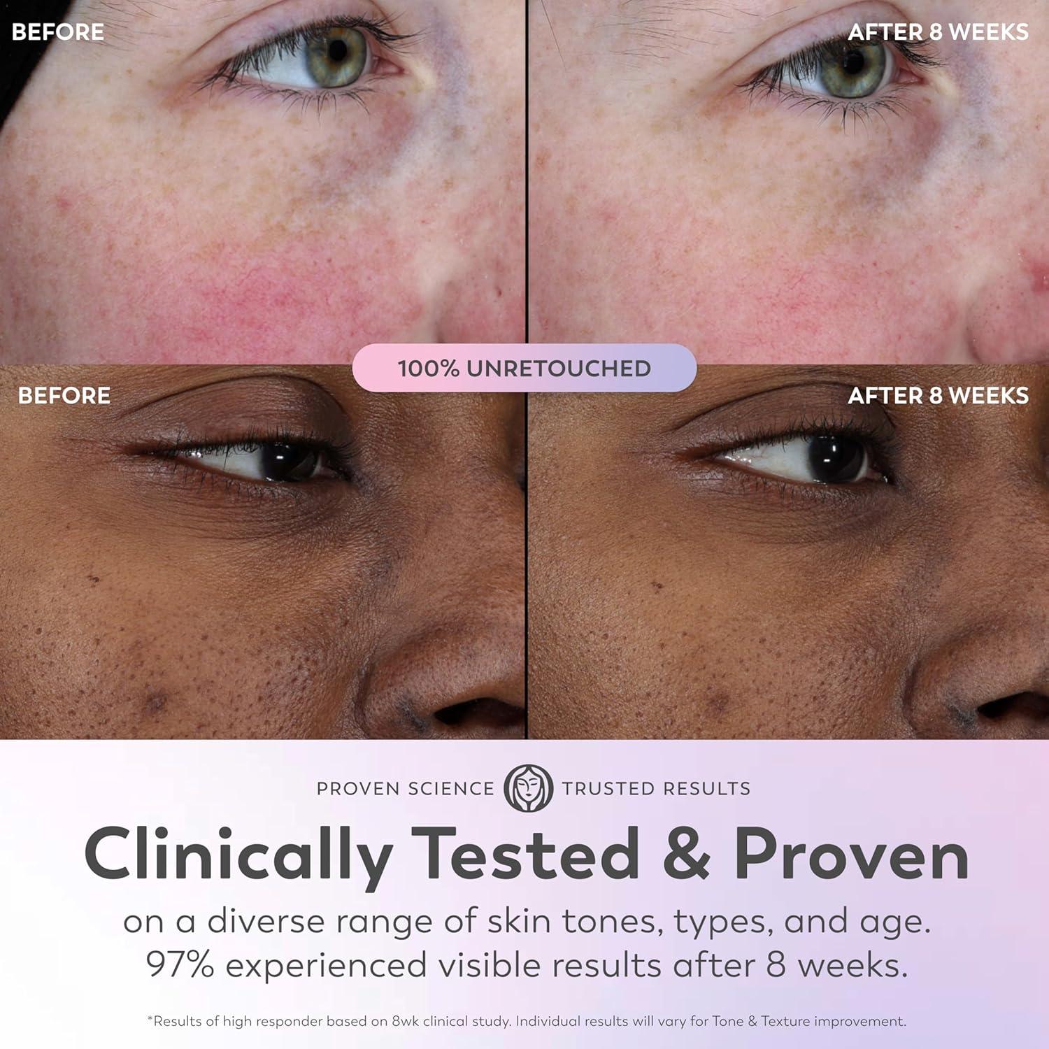 imageOlay Super Serum  Niacinamide Vitamin C ampamp E Collagen Peptide AHA  5in1 Skin Care Benefits for Face  Healthy Glow Brightening Hydrating Smoothing Firming Evens Tone AntiAging 17 Oz17 Fl Oz Pack of 1