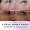 imageOlay Super Serum  Niacinamide Vitamin C ampamp E Collagen Peptide AHA  5in1 Skin Care Benefits for Face  Healthy Glow Brightening Hydrating Smoothing Firming Evens Tone AntiAging 17 Oz1 Fl Oz Pack of 1